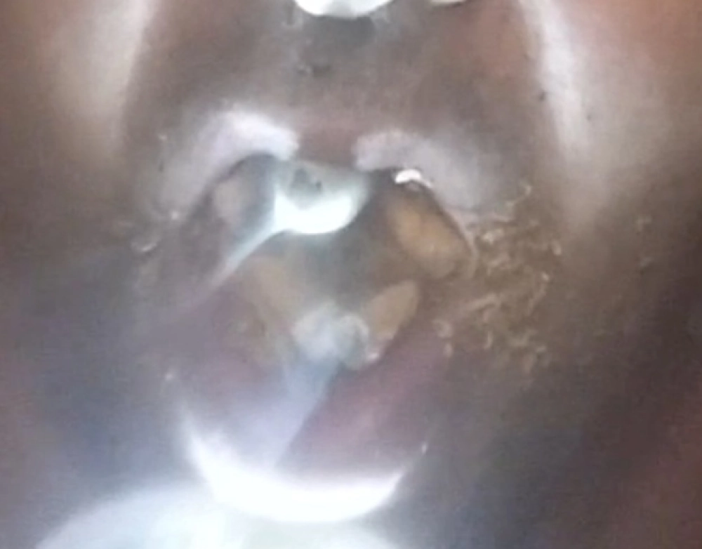 Cenicerohumano4 Soy un cenicero  estoy afalto de mucho humo y colillas en mi boca por badalona  - 1