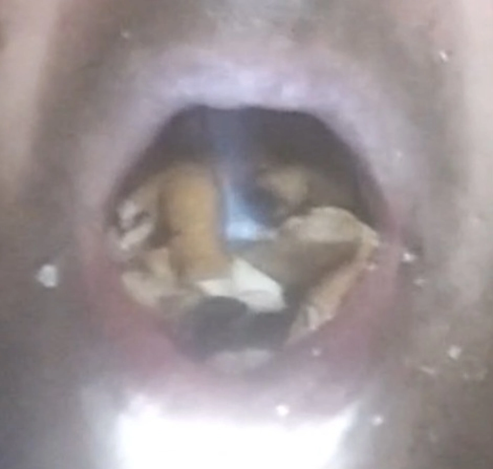 Cenicerohumano4 Soy un cenicero  estoy afalto de mucho humo y colillas en mi boca por badalona  - 4
