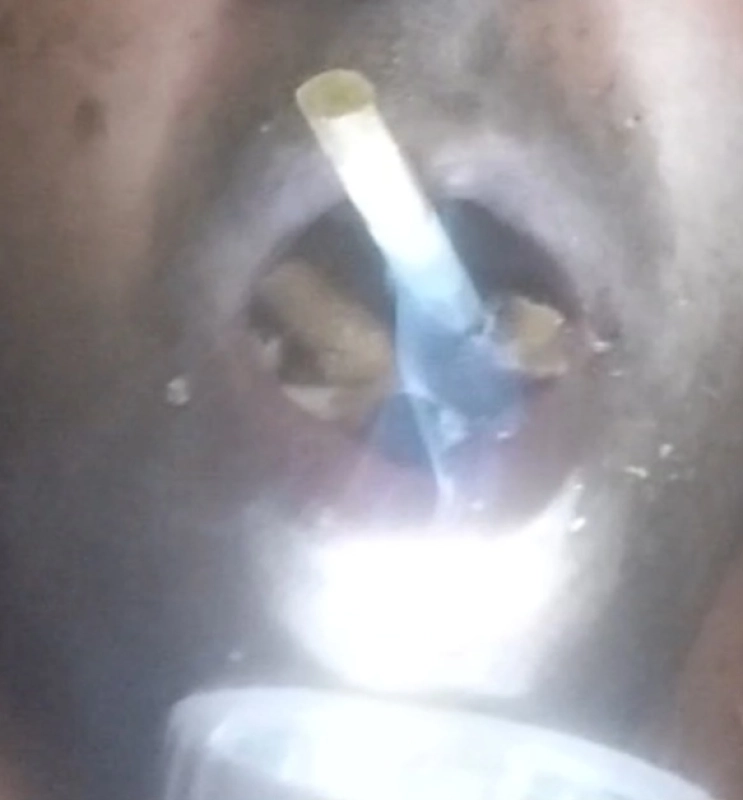 Cenicerohumano4 Soy un cenicero  estoy afalto de mucho humo y colillas en mi boca por badalona  - 2